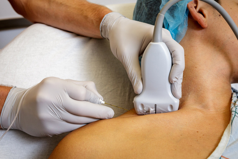 A nerve block being applied to a patient (stock image)
