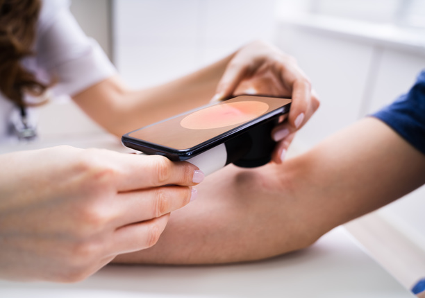 Doctor examining patient skin using a camera