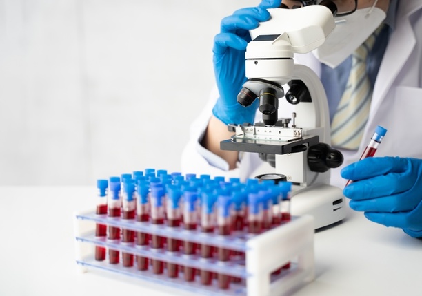 Doctor examining blood samples under a microscope for PSA and PSE blood tests, essential for prostate cancer diagnostics.
