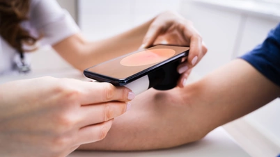 Doctor examining patient skin using a camera