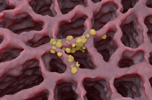 Small cancer tumors on the lung tissue: lung cancer (LC) – isometric view 3d illustration