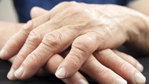 Hands with signs of arthritis resting on a table.