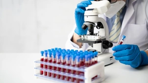 Doctor examining blood samples under a microscope for PSA and PSE blood tests, essential for prostate cancer diagnostics.
