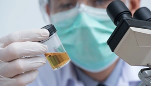 Man looks at urine in test tube