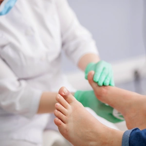 An image of a patients foot