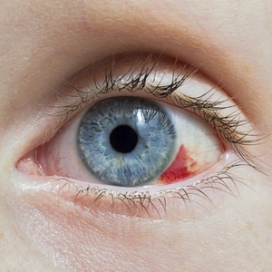 diabetic-eye-treatment