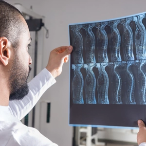 Radiologist analysing X-ray image with human spine in consulting room